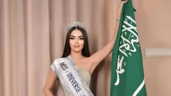 رومي القحطاني اليوم | تفاصيل إصابتها في الوجه وهل تؤثر على مشاركتها في ملكة جمال المرأة 2025؟